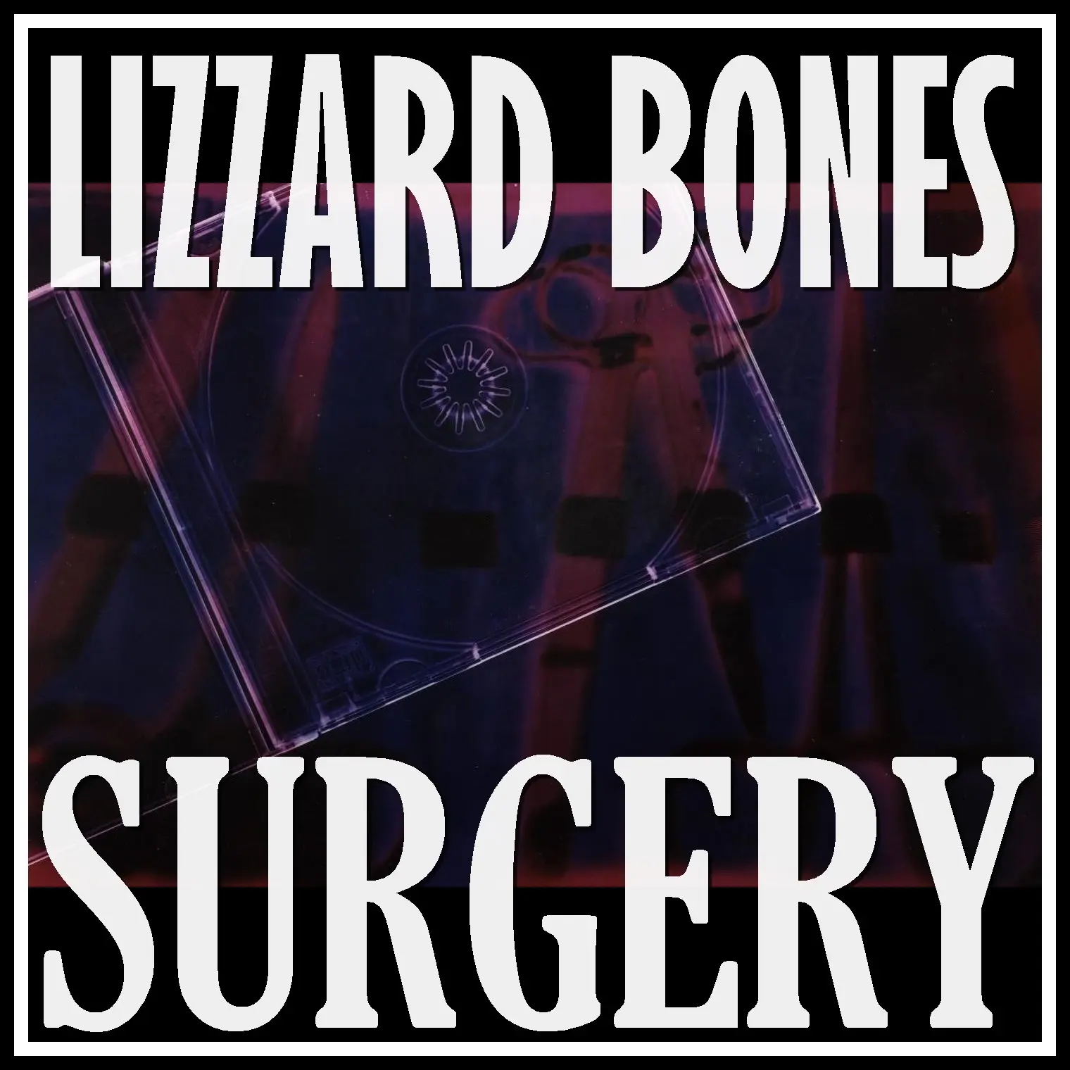 surgery